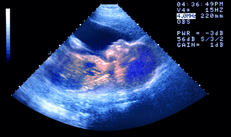 A scan of a baby in the womb.